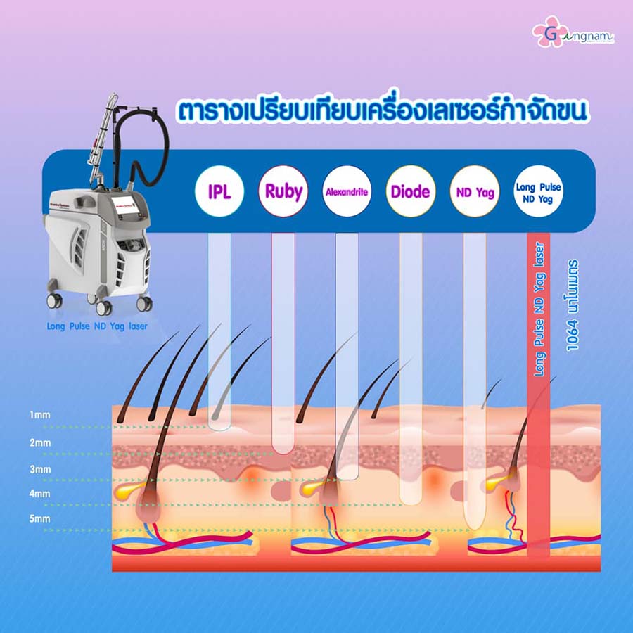 เปรียบเทียบเครื่องเลเซอร์รักแร้-แต่ละแบบ