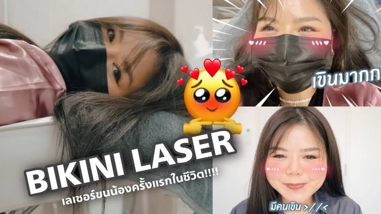 bikini laser ครั้งแรก