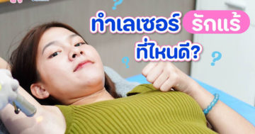 เลเซอร์รักแร้ ที่ไหนดี