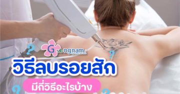 วิธีลบรอยสัก-แบบไหนได้ผลเป็นธรรมชาติที่สุด