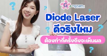 กำจัดขนด้วย-Diode-laser