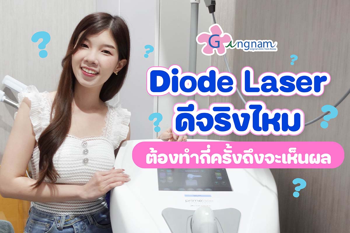 ก่อนทำควรรู้ Diode laser คือ? เหมาะกับคนเอเชียไหม ทำแล้วขนไม่หลุดเพราะ