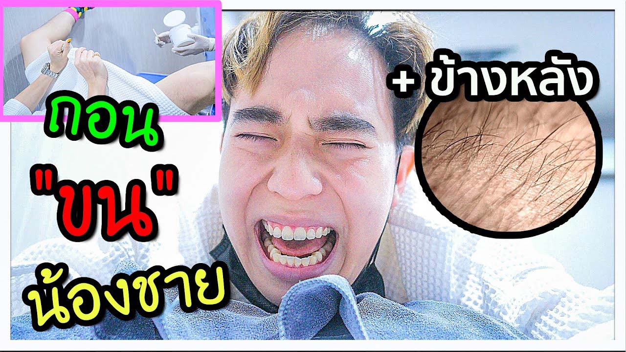 รีวิว กำจัดขนน้องชาย