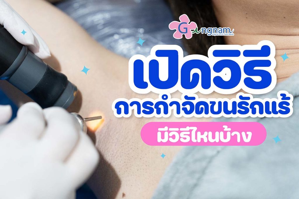 แนะนำ วิธีกำจัดขนรักแร้