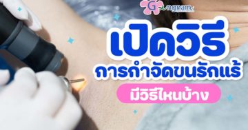 แนะนำ วิธีกำจัดขนรักแร้